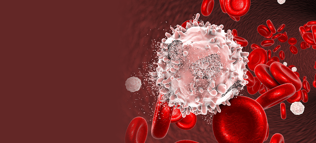 Leukemia Symptoms – Blood Cancer Signs Appearing Early